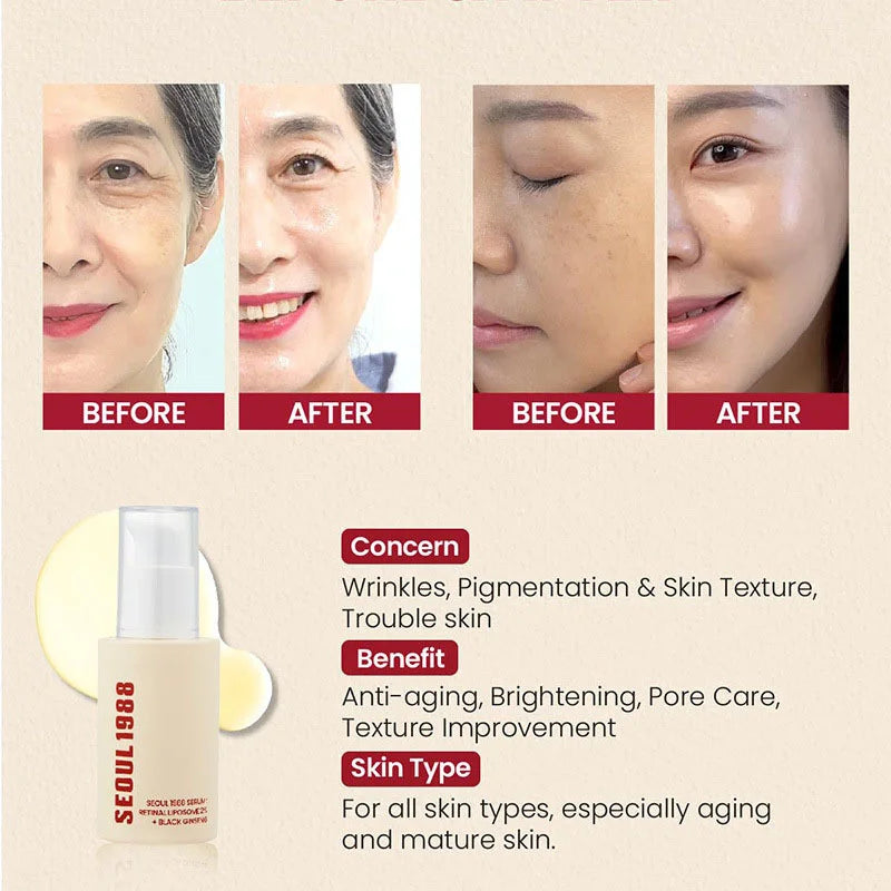Seoul 1988 Anti-Aging Trio