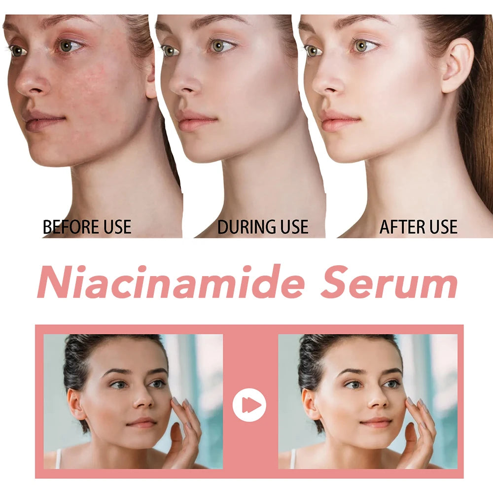 SERUM MAGIQUE A LA NIACINAMIDE POUR RETRECISSEMENT DES PORES