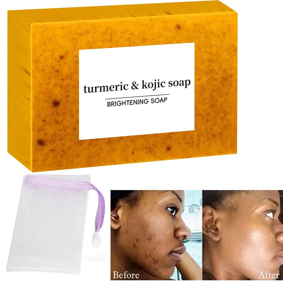SAVON AU CURCUMA ET A L'ACIDE KOJIQUE ANTI-TACHES BRUNES ET ANTI -ACNE